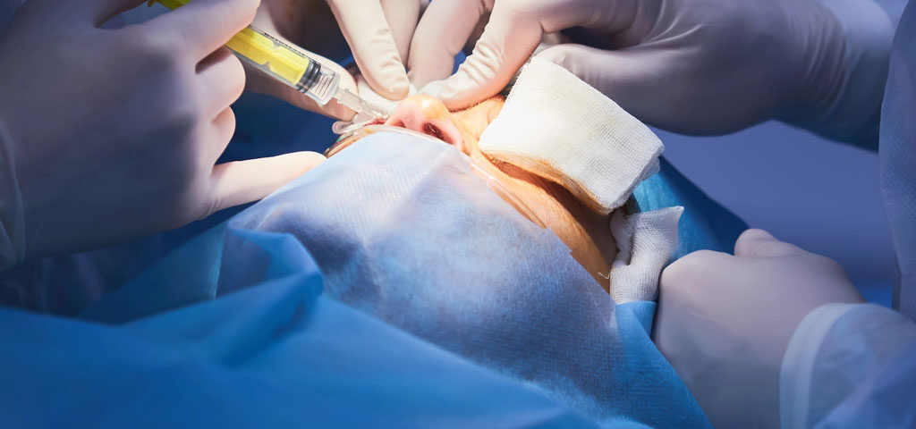 blefaroplastyka przebieg zabiegu