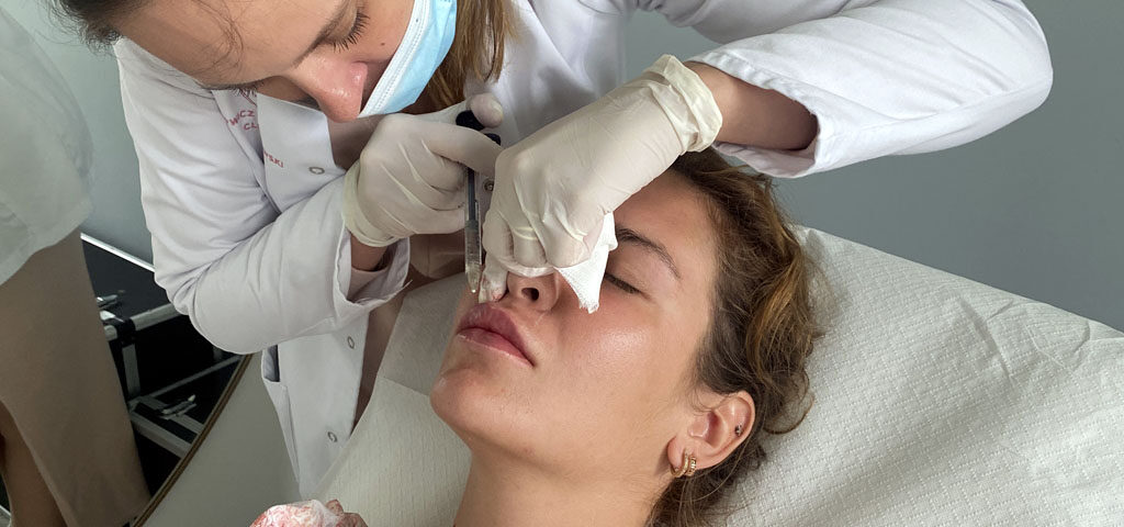 wypełnianie ust kwasem hialuronowym wypełnianie ust kwasem hialuronowym