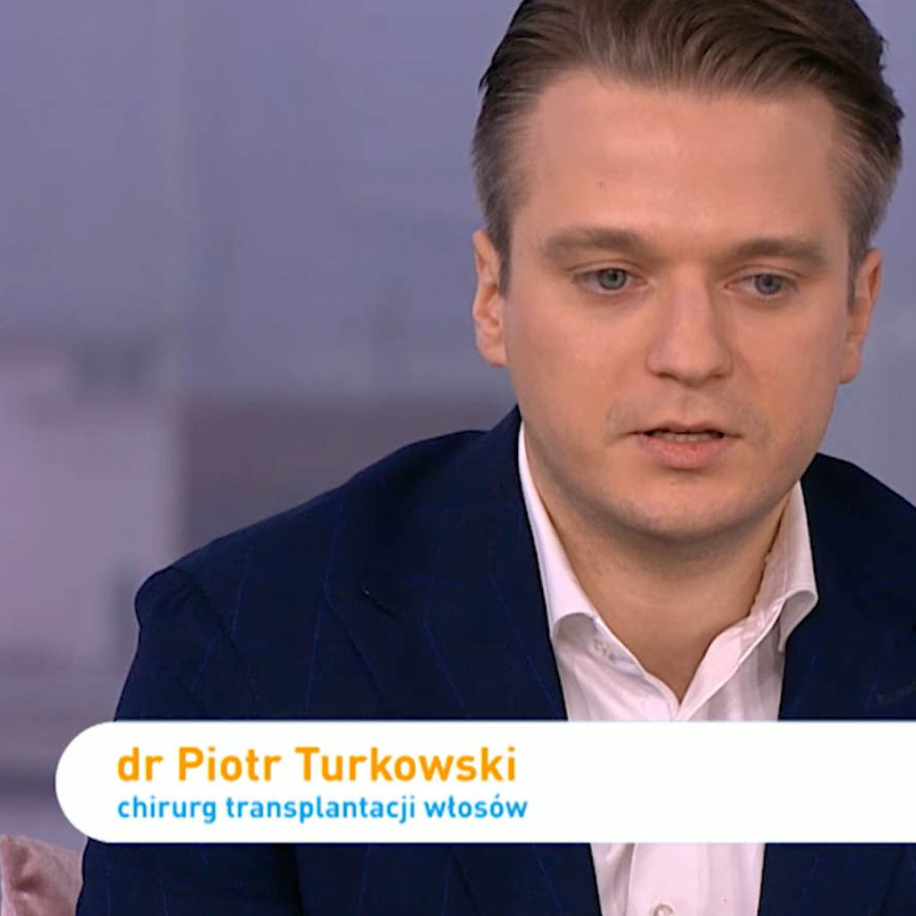 Adrian Szymaniak ze „Ślubu od pierwszego wejrzenia” miał przeszczep włosów: „Chciałem rzucić grzywą”
