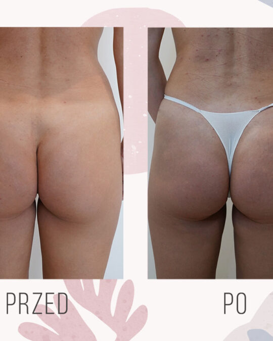 modelowanie posladkow 3