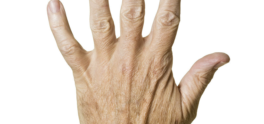 starzejące sie dłonie