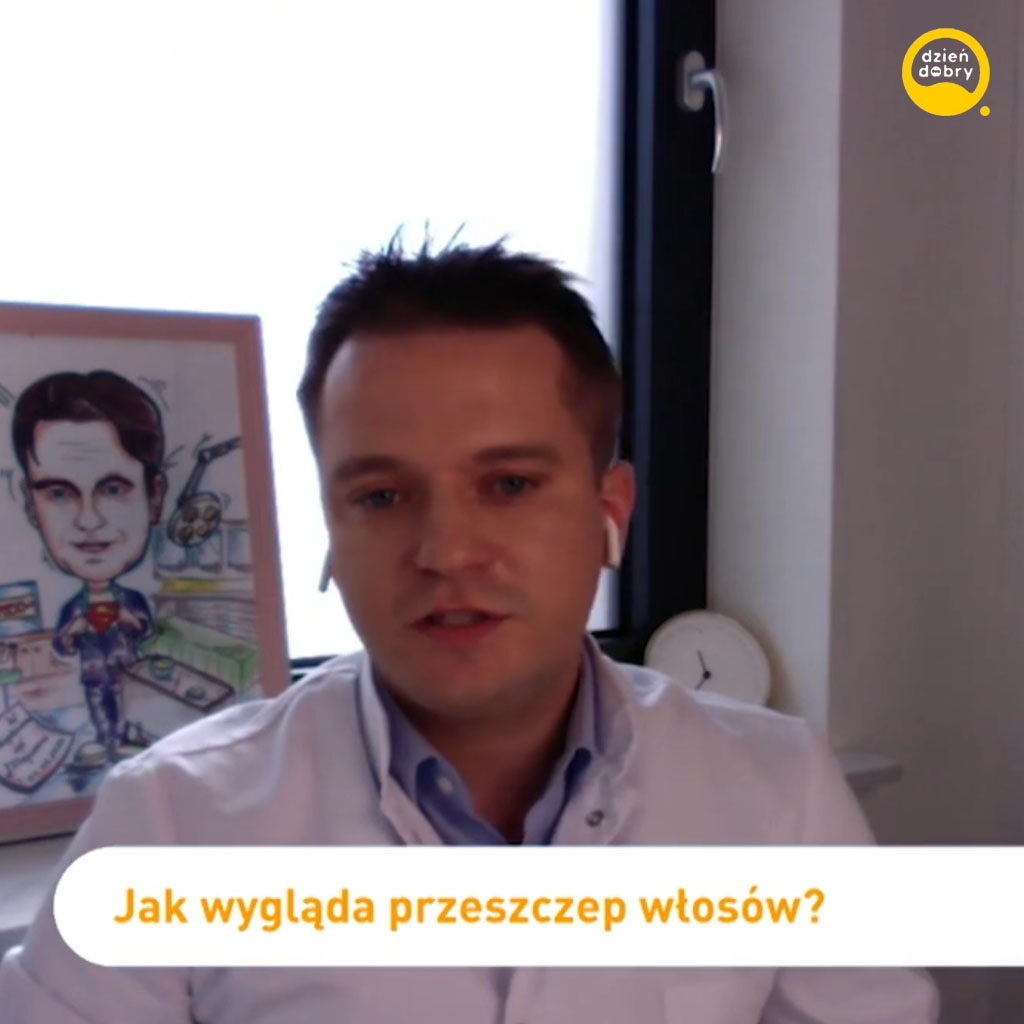 Dr Turkowski o przeszczepie włosów u gwiazd