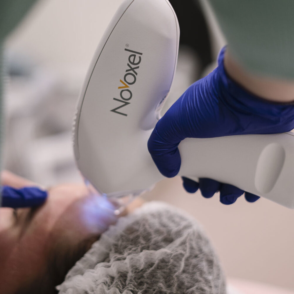 Technologia: Laser TIXEL 2 Warszawa | OT.CO Clinic