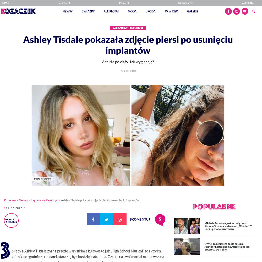 Ashley Tisdale pokazała zdjęcie piersi po usunięciu implantów – komentuje dr Piotr Turkowski