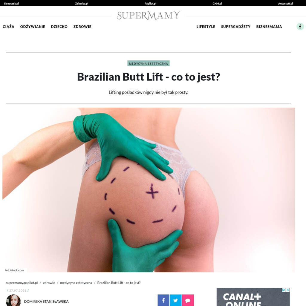 Brazilian Butt Lift – co to jest?