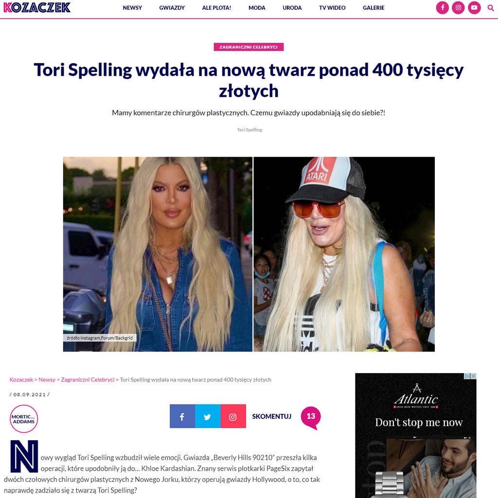 Tori Spelling wydała na nową twarz ponad 400 tysięcy złotych