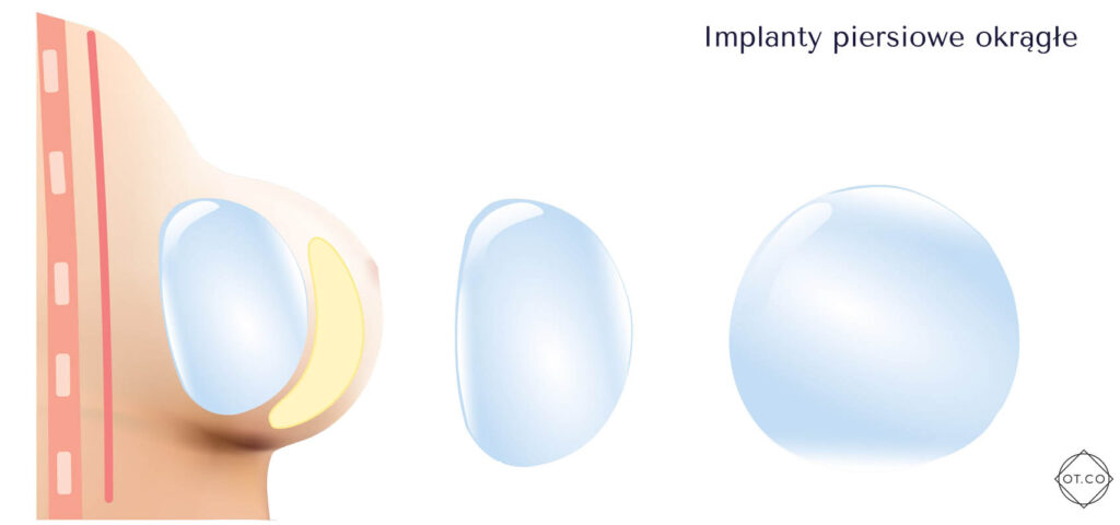 implanty piersiowe okragle