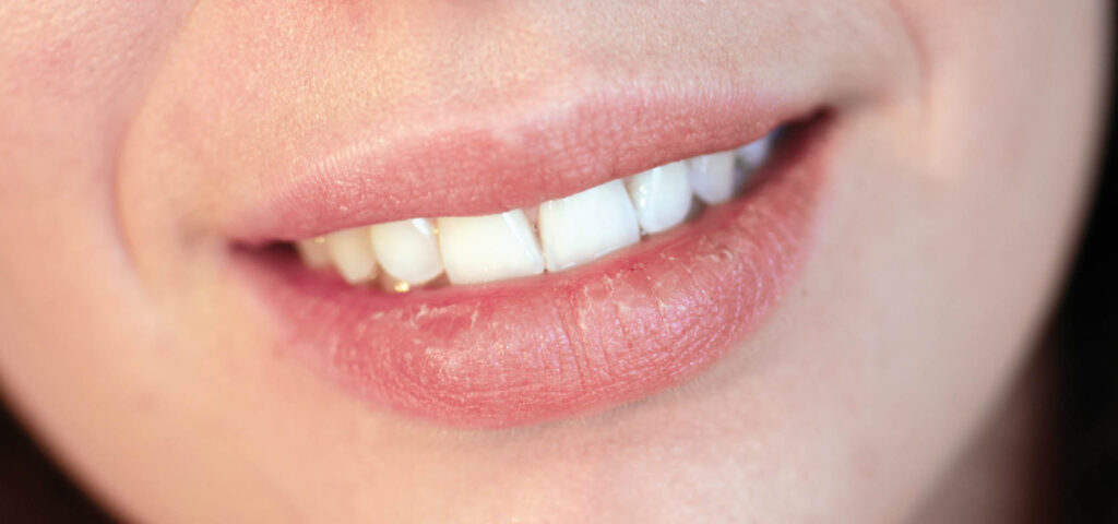 suche usta suche usta