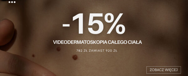 wideodermatoskopia ciala promocja