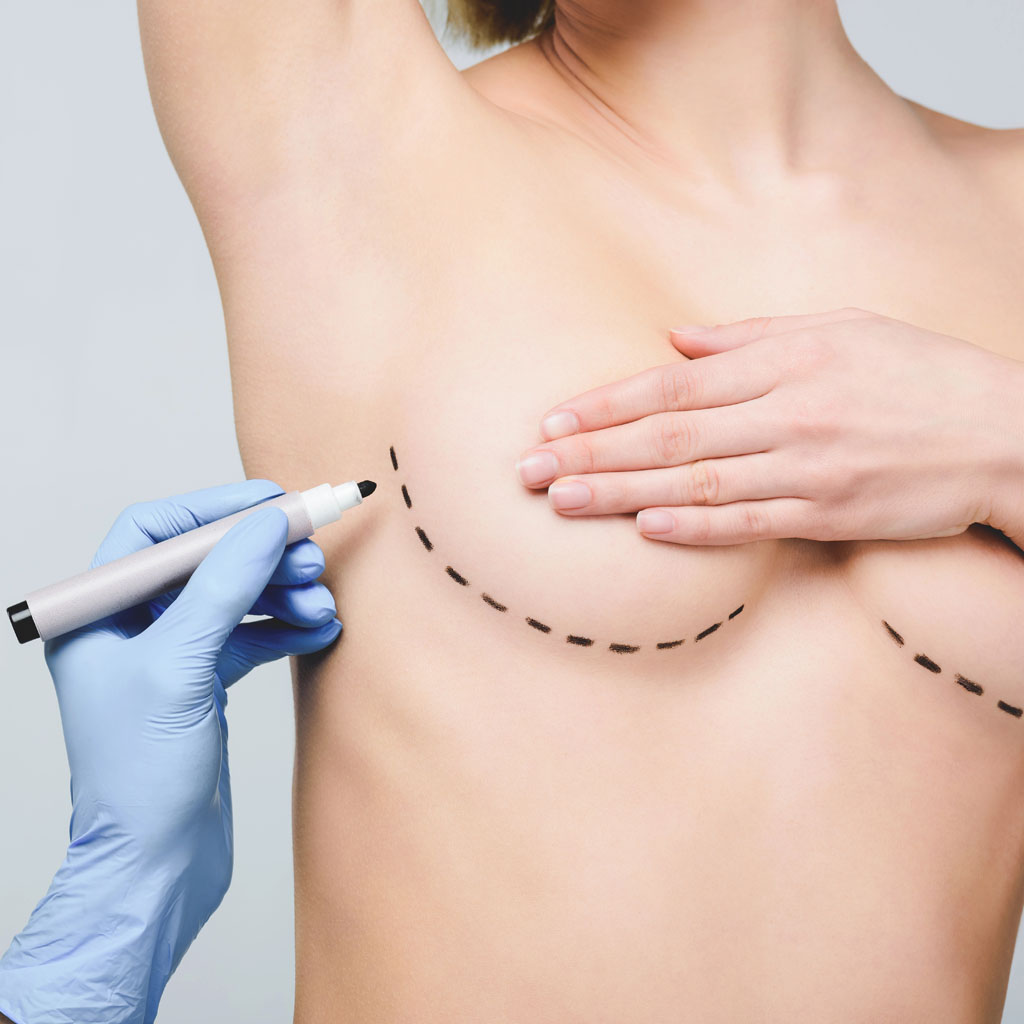 dla kogo zabieg powiekszania piersi