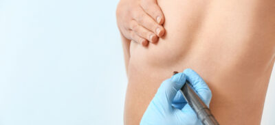 modelowanie korekta objetosci piersi