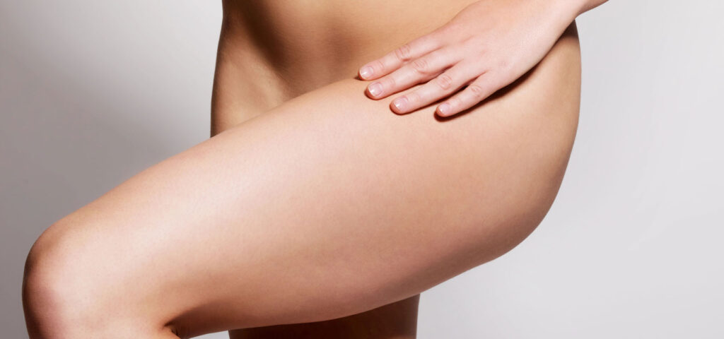 bryczesy na udach – nadmiar tkanki tłuszczowej w bocznej części ud