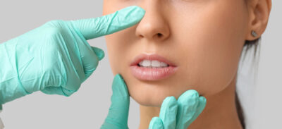 planowanie operacji nosa lekarz analiza twarzy