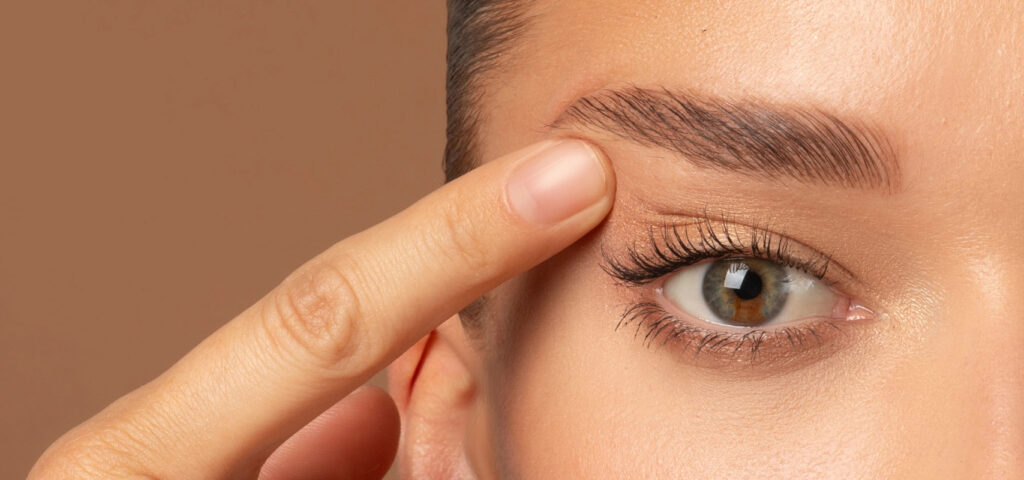 Przykład zaawansowanego nadmiaru skóry powiek górnych