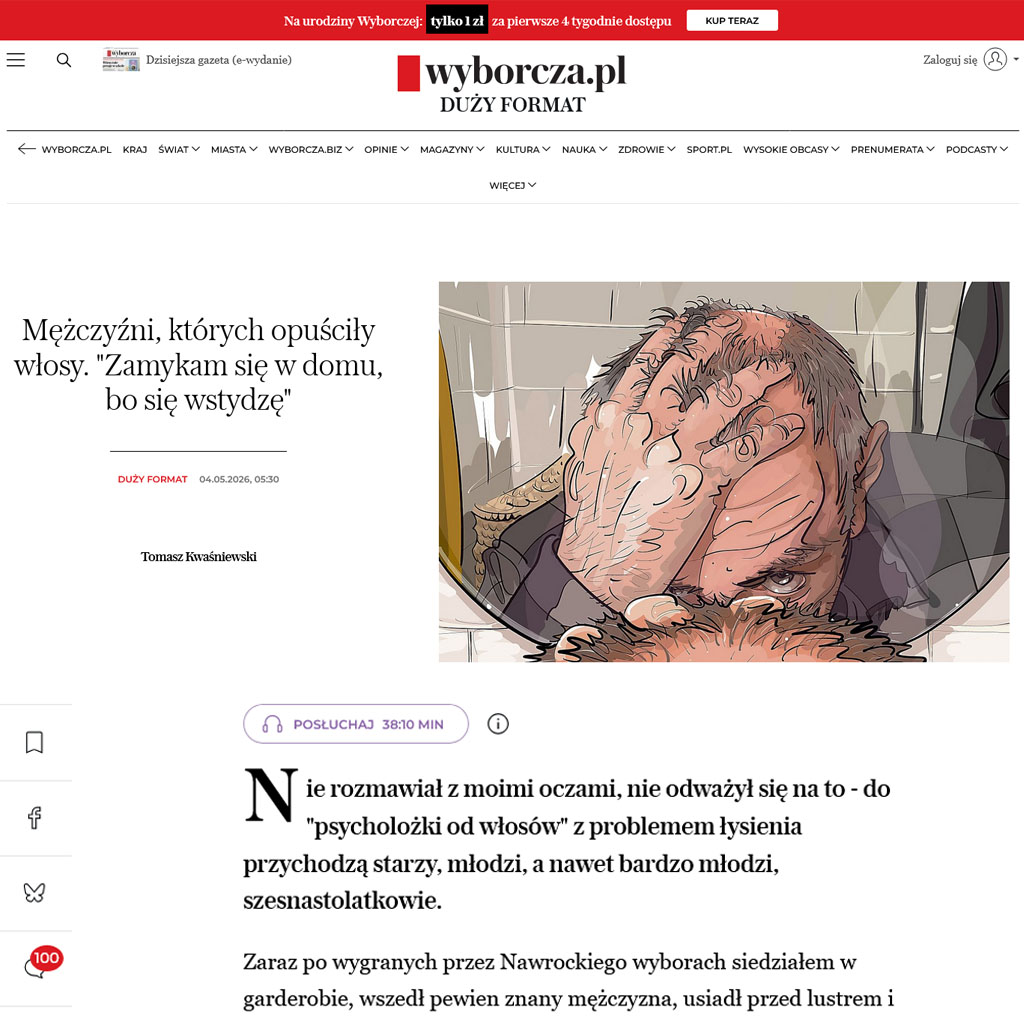 Mężczyźni, których opuściły włosy. „Zamykam się w domu, bo się wstydzę”